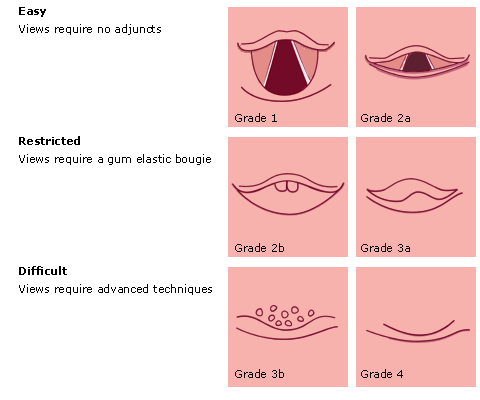 Cook's Modified Classification