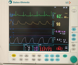 Adequacy of Preoxygenation